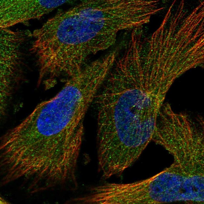 INPP5B Antibody - BSA Free Immunocytochemistry/ Immunofluorescence: INPP5B Antibody [NBP1-89439]