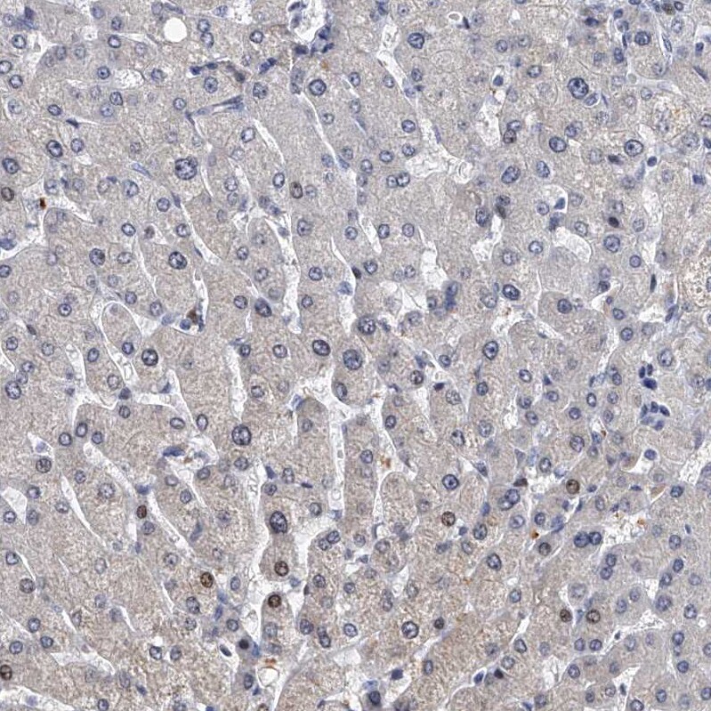 TESK2 Antibody - BSA Free Immunohistochemistry-Paraffin: TESK2 Antibody - BSA Free [NBP1-89442]
