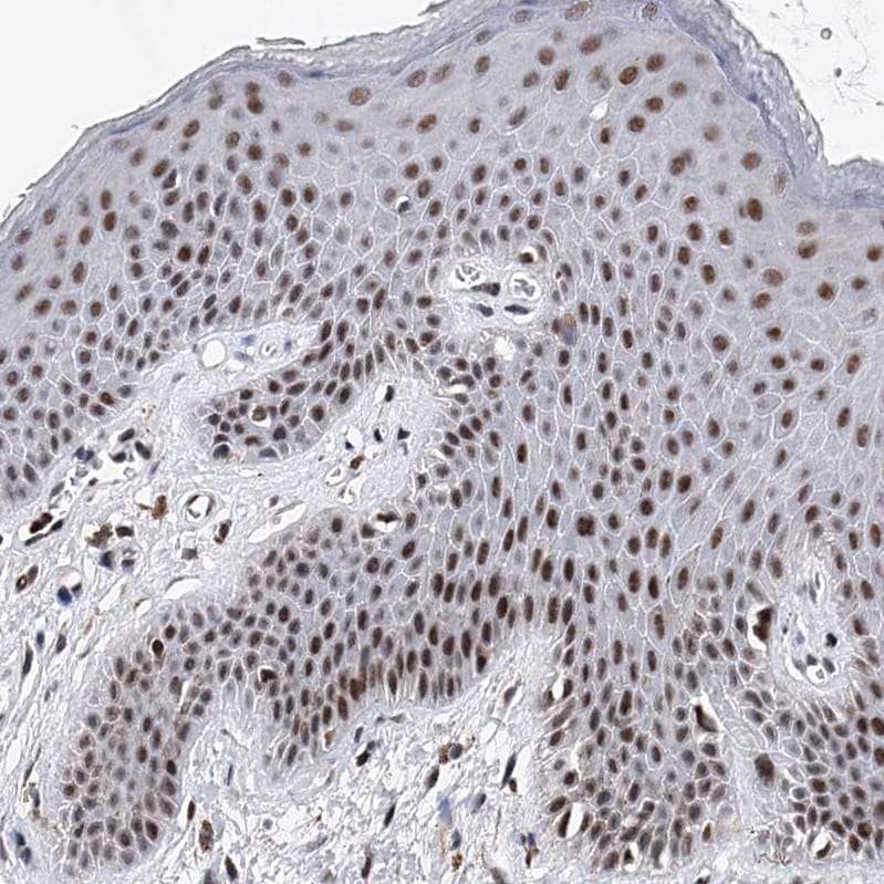 TESK2 Antibody - BSA Free Immunohistochemistry-Paraffin: TESK2 Antibody - BSA Free [NBP1-89442]