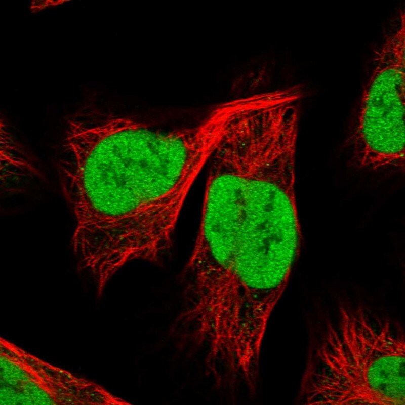 YAF2 Antibody - BSA Free Immunocytochemistry/ Immunofluorescence: YAF2 Antibody - BSA Free [NBP1-89444]