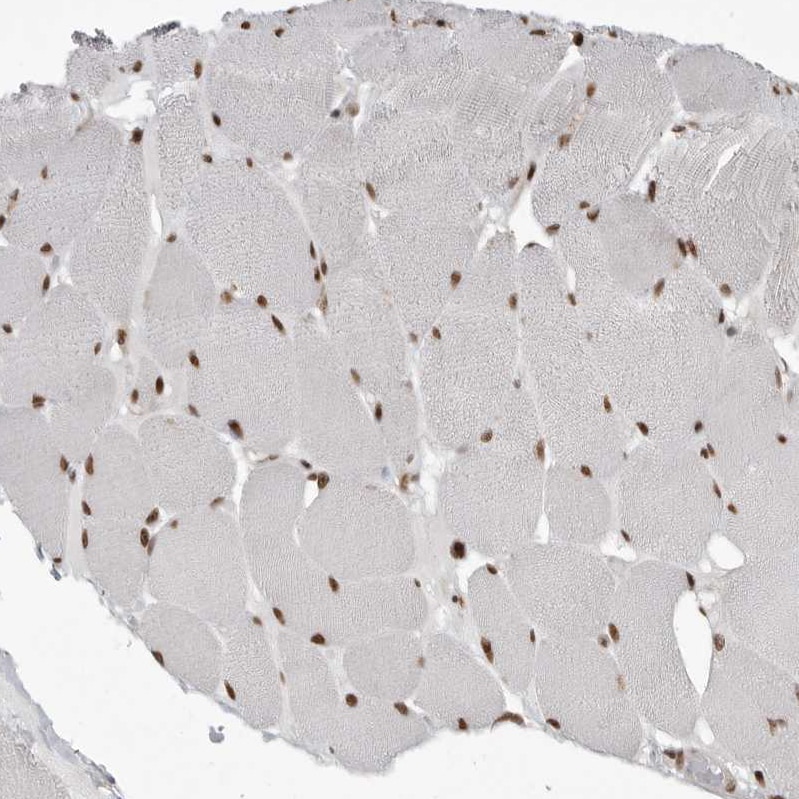 YAF2 Antibody - BSA Free Immunohistochemistry-Paraffin: YAF2 Antibody - BSA Free [NBP1-89444]