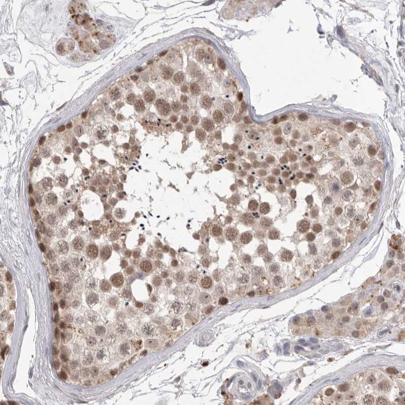 HUS1 Antibody - BSA Free Immunohistochemistry-Paraffin: HUS1 Antibody - BSA Free [NBP1-89445]