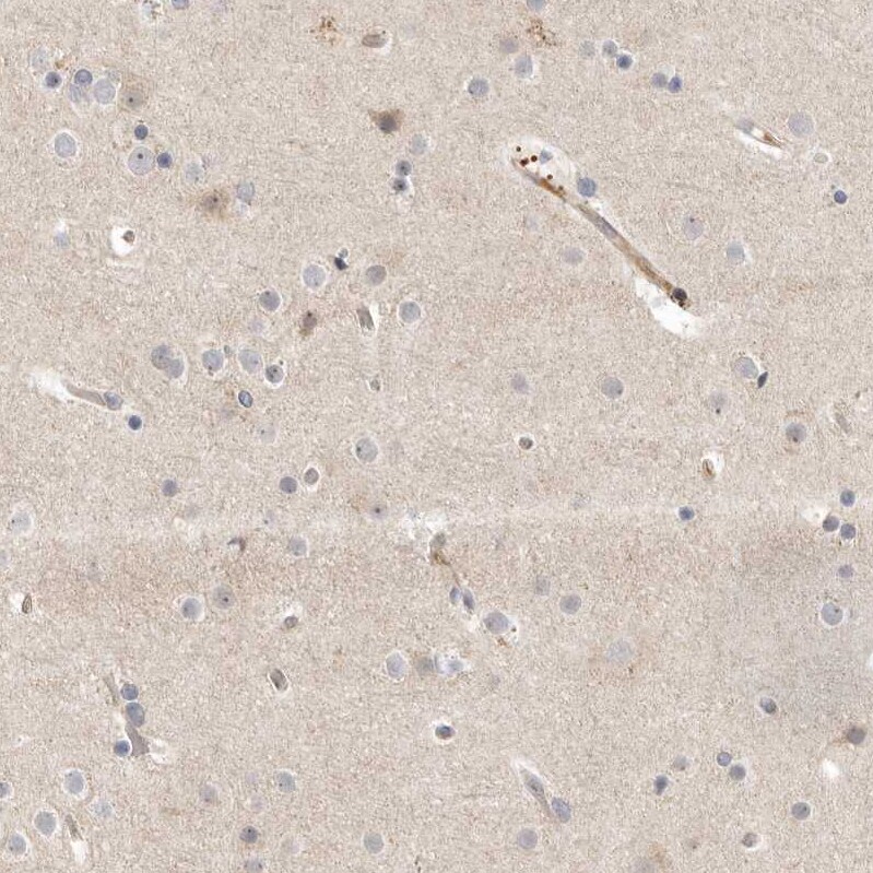 KIF2B Antibody - BSA Free Immunohistochemistry-Paraffin: KIF2B Antibody - BSA Free [NBP1-89446]