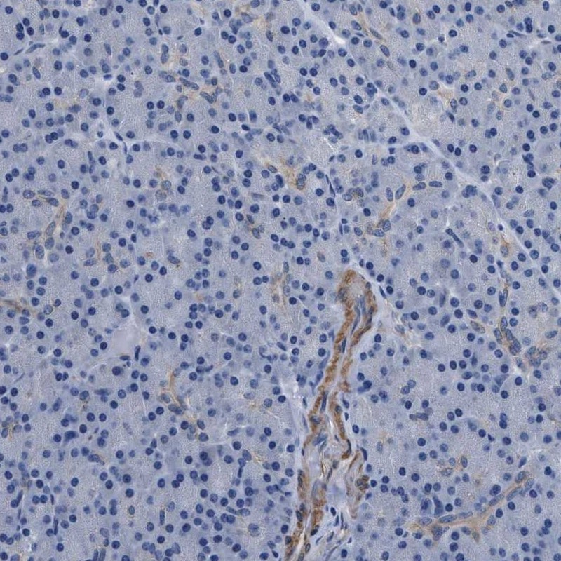 PARG Antibody - BSA Free Immunohistochemistry-Paraffin: PARG Antibody - BSA Free [NBP1-89450]