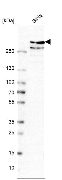 TPR Antibody - BSA Free Western Blot: TPR Antibody - BSA Free [NBP1-89451]