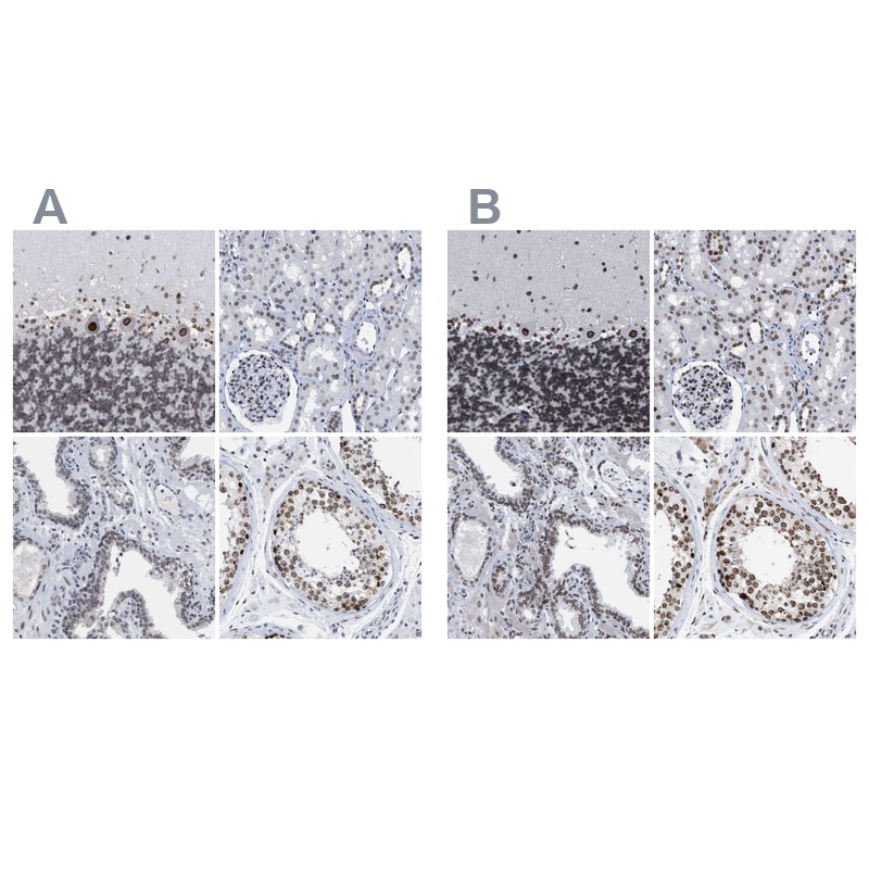 TPR Antibody - BSA Free Immunohistochemistry-Paraffin: TPR Antibody - BSA Free [NBP1-89451]