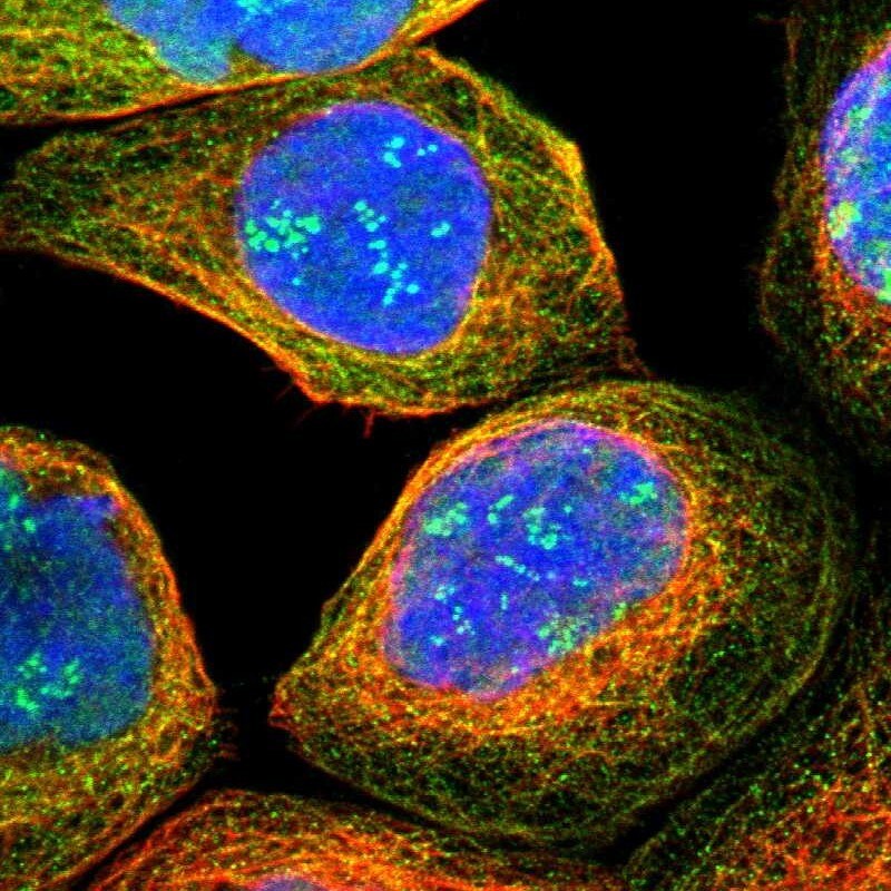 TWISTNB Antibody - BSA Free Immunocytochemistry/ Immunofluorescence: TWISTNB Antibody [NBP1-89454]