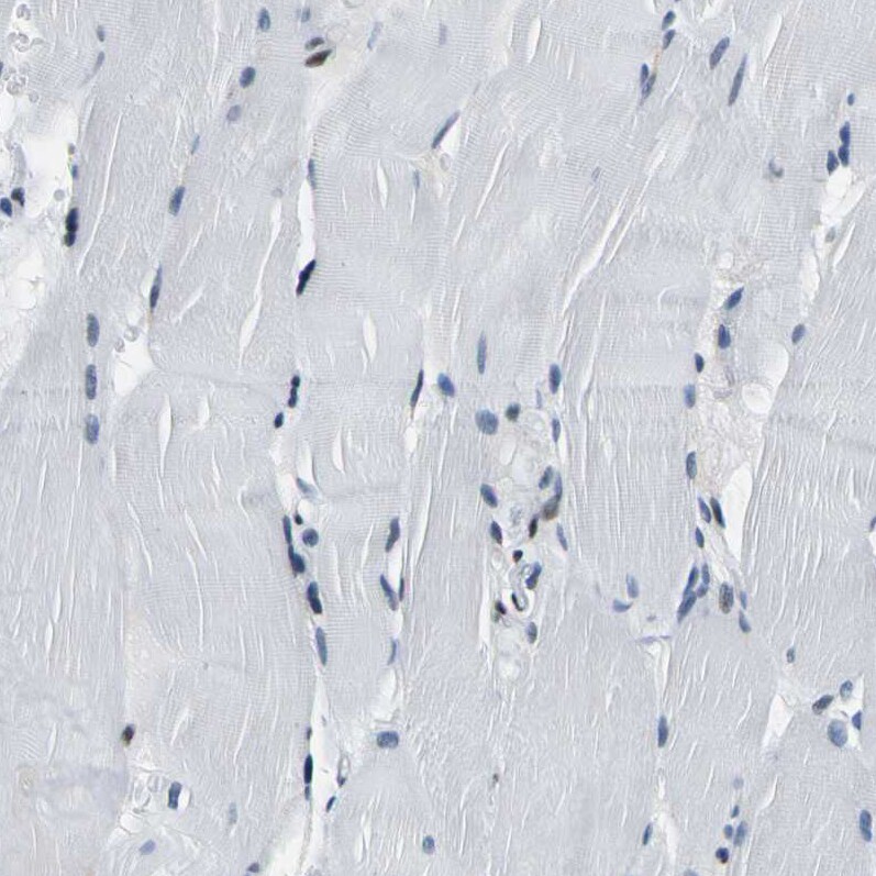 SP1 Antibody - BSA Free Immunohistochemistry-Paraffin: SP1 Antibody [NBP1-89458]