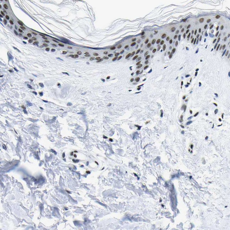 SP1 Antibody - BSA Free Immunohistochemistry-Paraffin: SP1 Antibody [NBP1-89458]