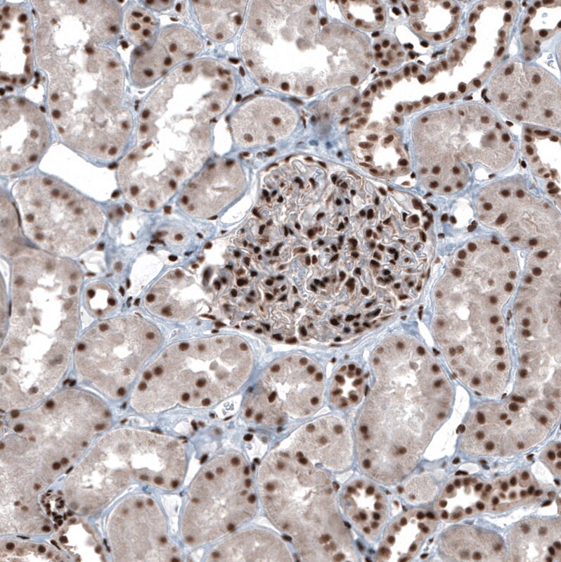 SP1 Antibody - BSA Free Immunohistochemistry-Paraffin: SP1 Antibody [NBP1-89458]