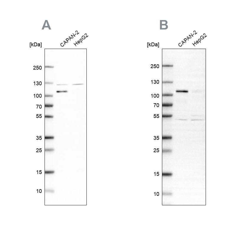 SP1 Antibody - BSA Free Western Blot: SP1 Antibody - BSA Free [NBP1-89458]