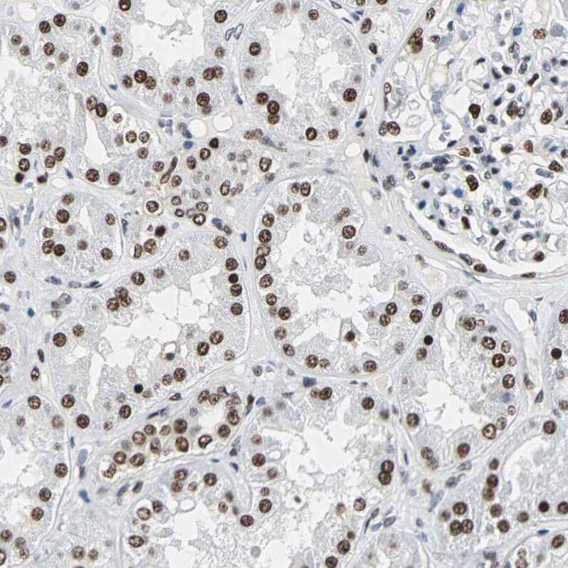 XRCC4 Antibody - BSA Free Immunohistochemistry-Paraffin: XRCC4 Antibody - BSA Free [NBP1-89463]