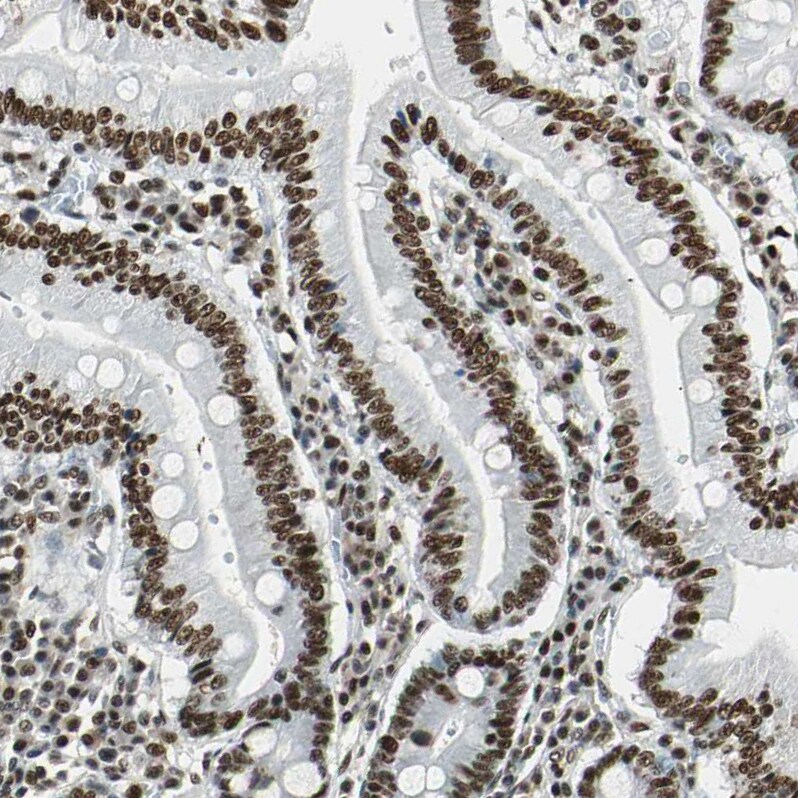 XRCC4 Antibody - BSA Free Immunohistochemistry-Paraffin: XRCC4 Antibody - BSA Free [NBP1-89463]