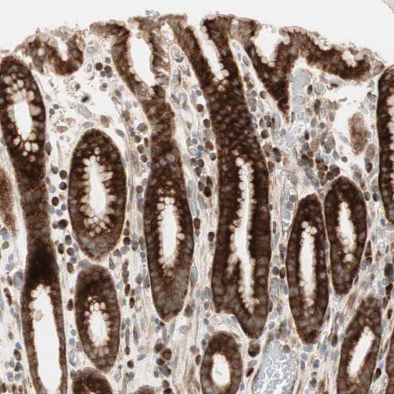 PPP2R5E Antibody - BSA Free Immunohistochemistry-Paraffin: PPP2R5E Antibody - BSA Free [NBP1-89464]