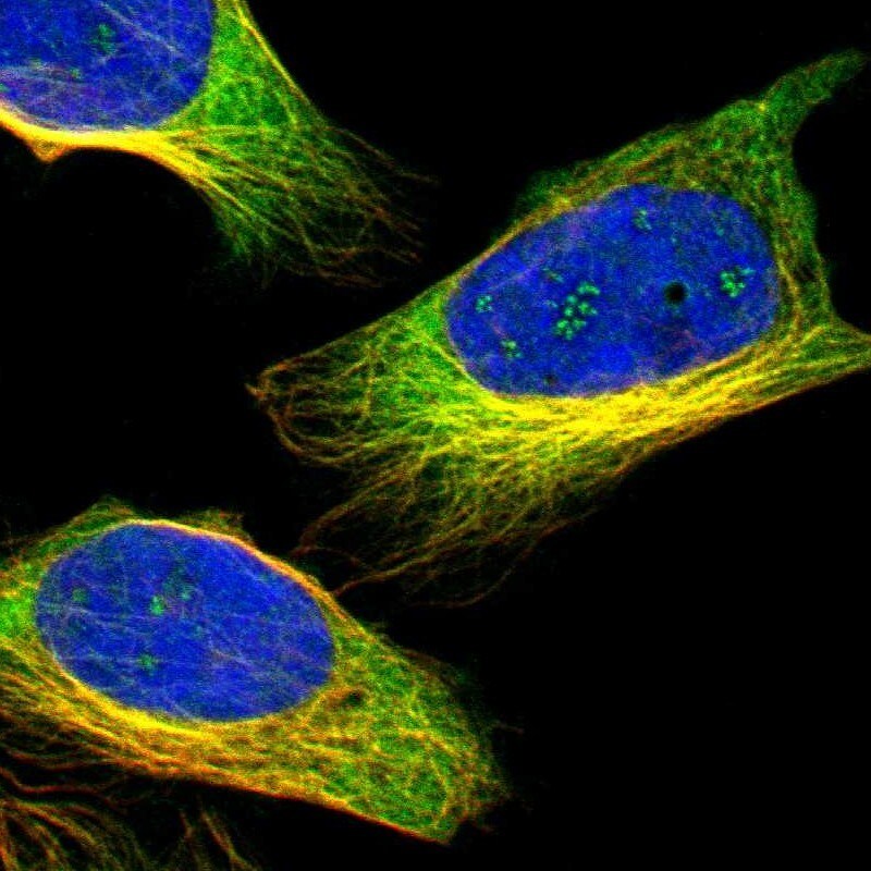 ZNF415 Antibody - BSA Free Immunocytochemistry/ Immunofluorescence: ZNF415 Antibody [NBP1-89466]