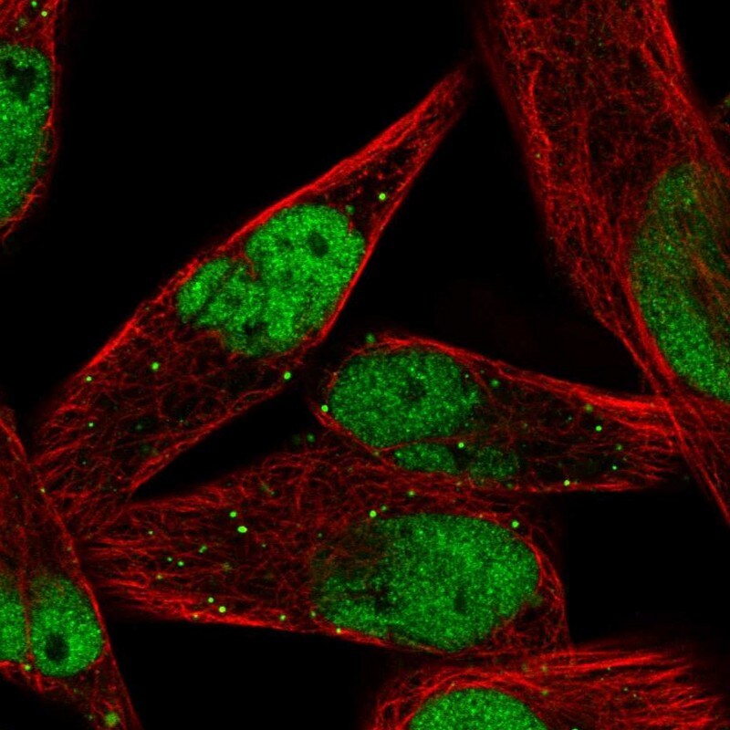 MEF2C Antibody - BSA Free Immunocytochemistry/ Immunofluorescence: MEF2C Antibody [NBP1-89468]