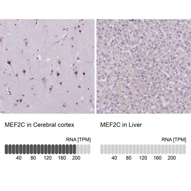 MEF2C Antibody - BSA Free Immunohistochemistry-Paraffin: MEF2C Antibody - BSA Free [NBP1-89468]