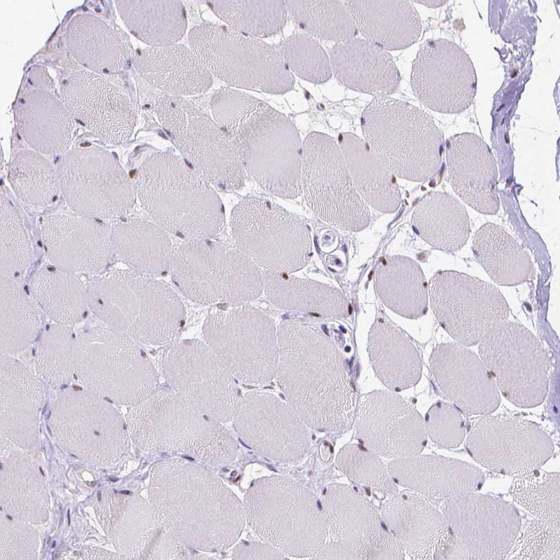 MEF2C Antibody - BSA Free Immunohistochemistry-Paraffin: MEF2C Antibody - BSA Free [NBP1-89468]