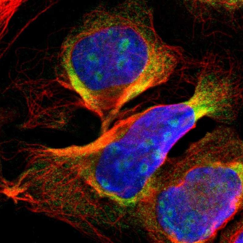 DDX24 Antibody - BSA Free Immunocytochemistry/ Immunofluorescence: DDX24 Antibody - BSA Free [NBP1-89472]