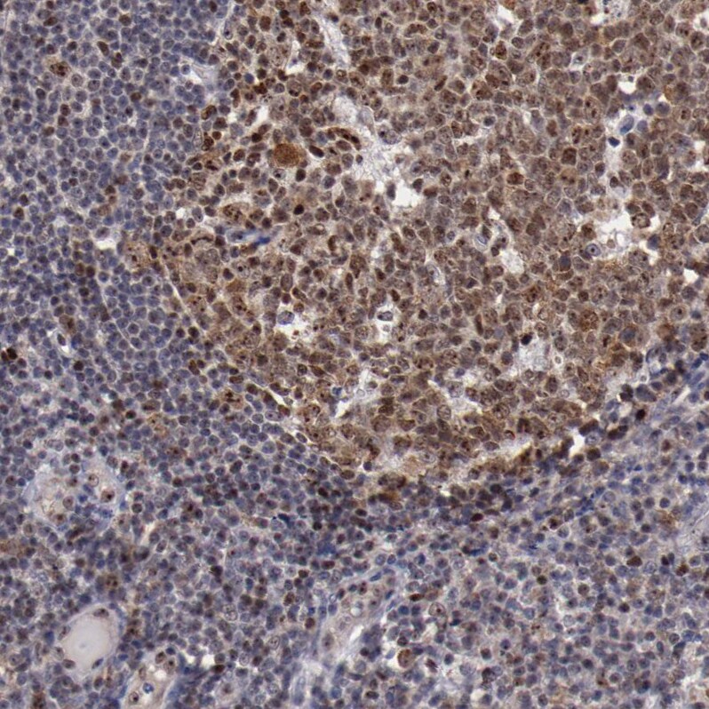 DDX24 Antibody - BSA Free Immunohistochemistry-Paraffin: DDX24 Antibody - BSA Free [NBP1-89472]