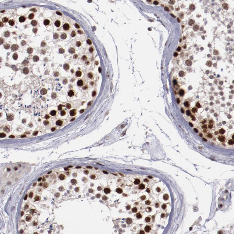 DDX24 Antibody - BSA Free Immunohistochemistry-Paraffin: DDX24 Antibody - BSA Free [NBP1-89472]