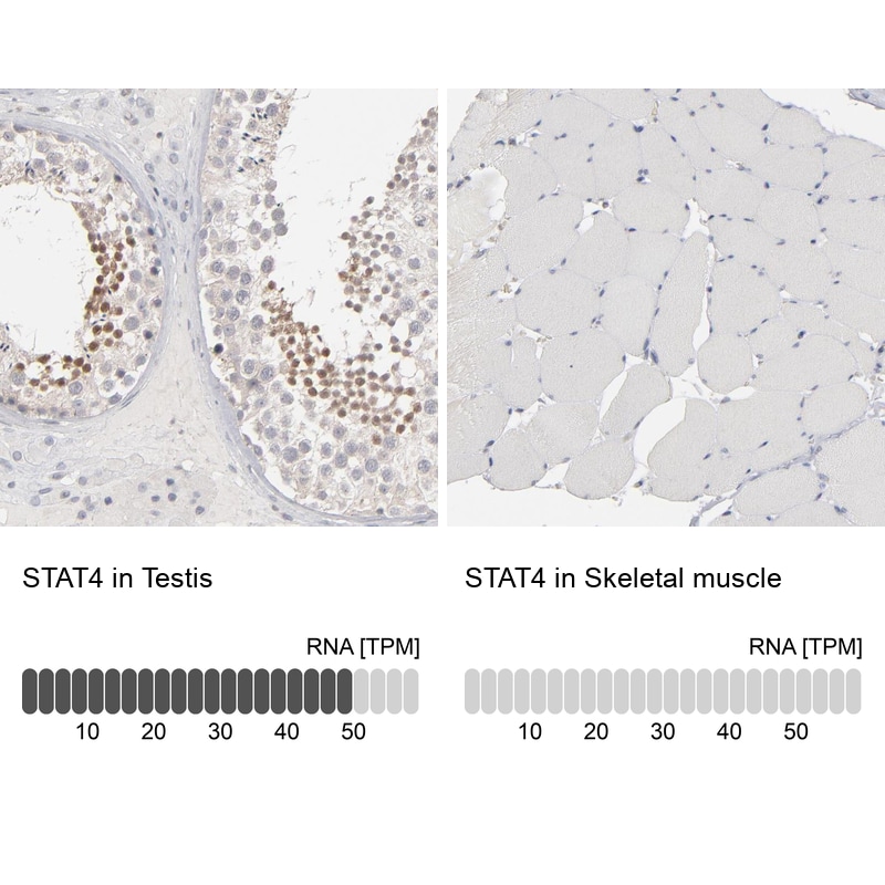 STAT4 Antibody - BSA Free Immunohistochemistry-Paraffin: STAT4 Antibody - BSA Free [NBP1-89474]