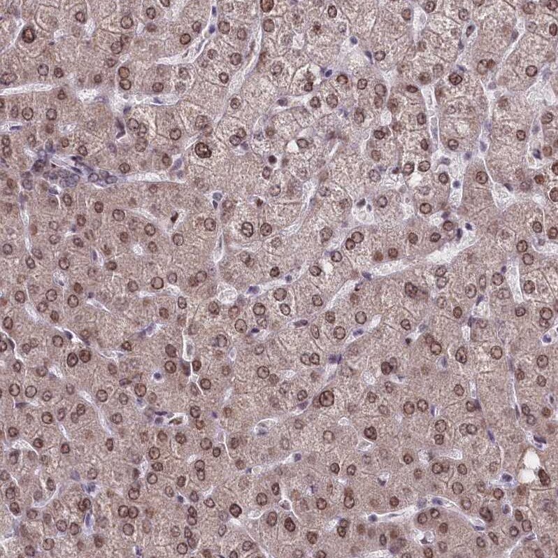 PPHLN1 Antibody - BSA Free Immunohistochemistry-Paraffin: PPHLN1 Antibody - BSA Free [NBP1-89480]