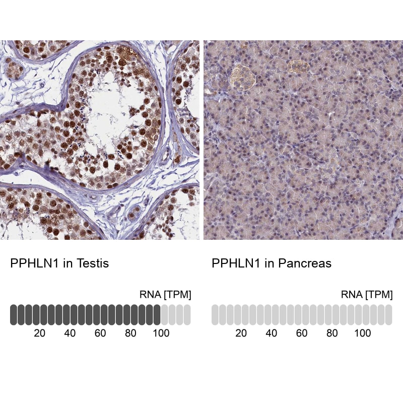 PPHLN1 Antibody - BSA Free Immunohistochemistry-Paraffin: PPHLN1 Antibody - BSA Free [NBP1-89480]