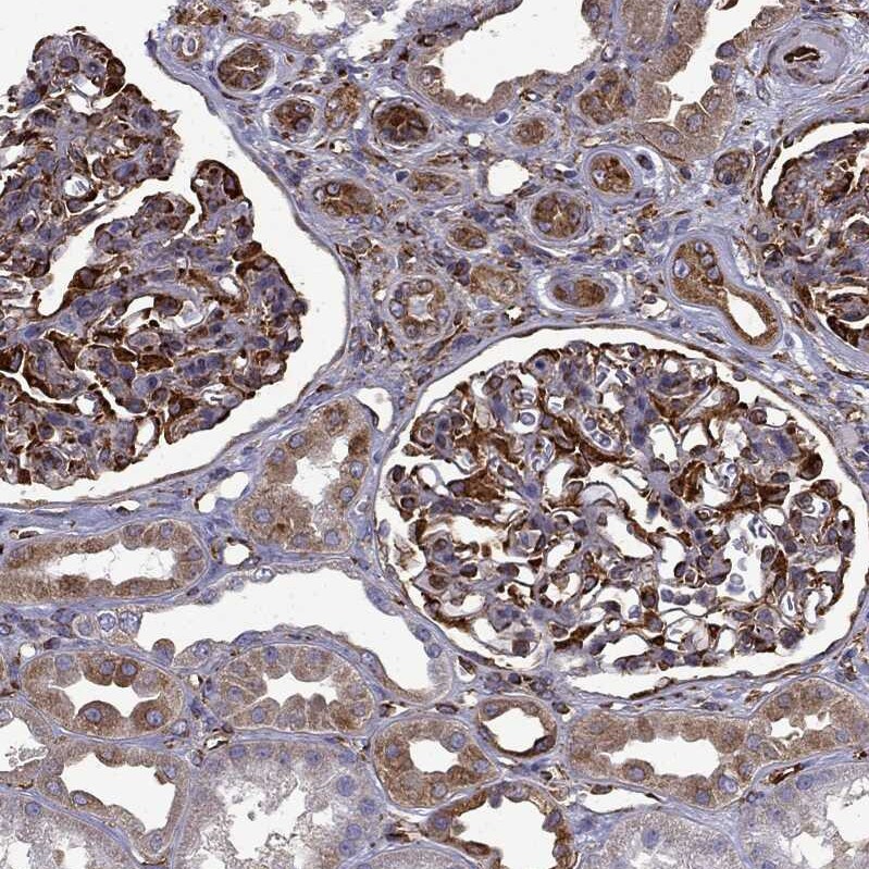 MAP4 Antibody - BSA Free Immunohistochemistry-Paraffin: MAP4 Antibody - BSA Free [NBP1-89483]