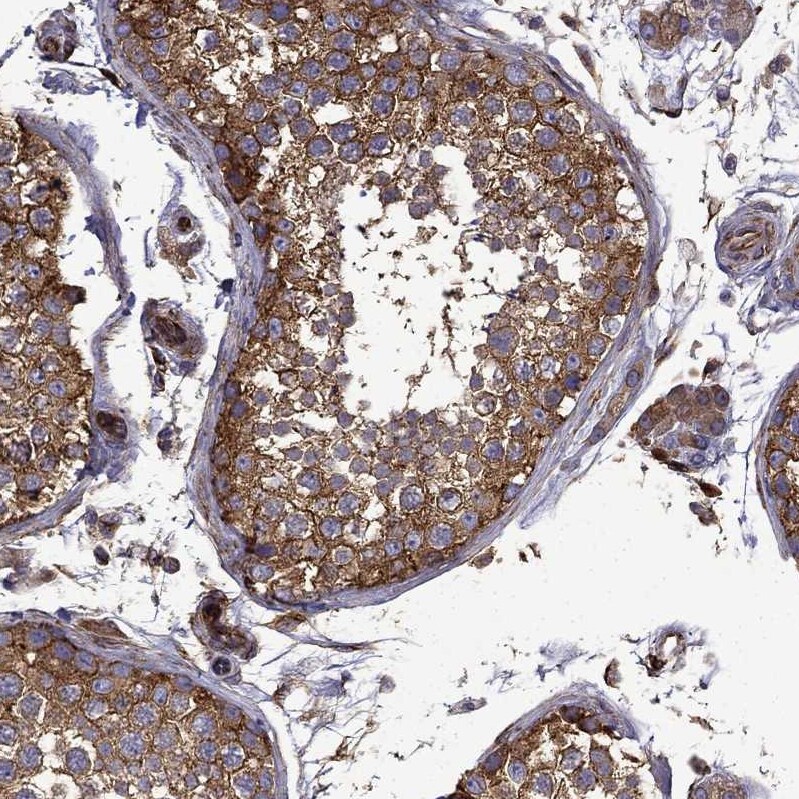 MAP4 Antibody - BSA Free Immunohistochemistry-Paraffin: MAP4 Antibody - BSA Free [NBP1-89483]