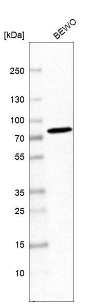 SNX2 Antibody - BSA Free Western Blot: SNX2 Antibody - BSA Free [NBP1-89485]