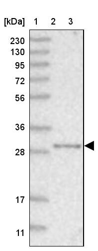 NIT2 Antibody - BSA Free Western Blot: NIT2 Antibody - BSA Free [NBP1-89486]