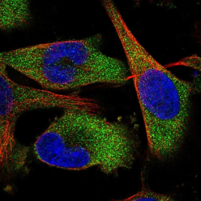QARS Antibody - BSA Free Immunocytochemistry/ Immunofluorescence: QARS Antibody - BSA Free [NBP1-89487]