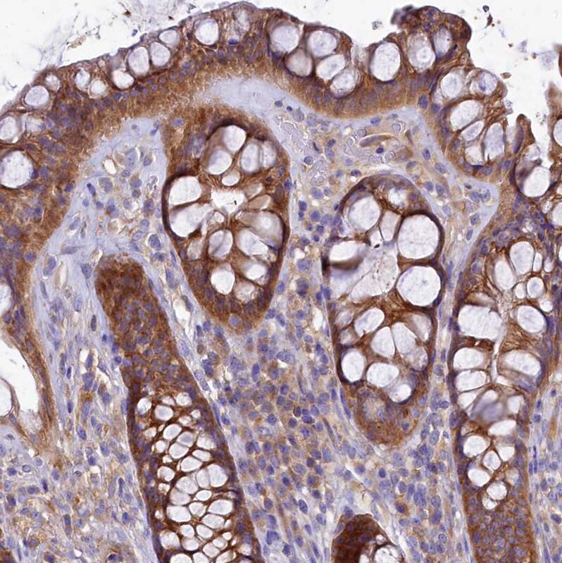 QARS Antibody - BSA Free Immunohistochemistry-Paraffin: QARS Antibody - BSA Free [NBP1-89487]