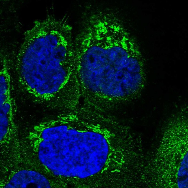 SUCLG1 Antibody - BSA Free Immunocytochemistry/ Immunofluorescence: SUCLG1 Antibody [NBP1-89489]