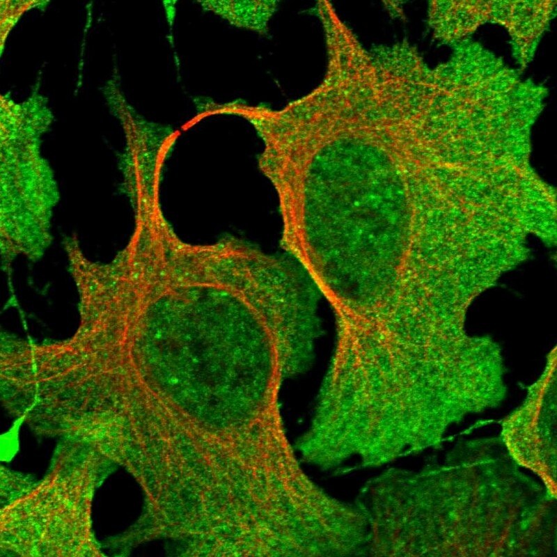 DPP3 Antibody - BSA Free Immunocytochemistry/ Immunofluorescence: DPP3 Antibody [NBP1-89493]