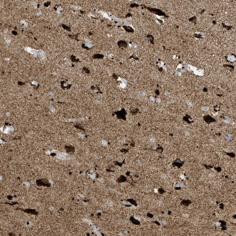 ATP5I Antibody - BSA Free Immunohistochemistry-Paraffin: ATP5I Antibody - BSA Free [NBP1-89496]