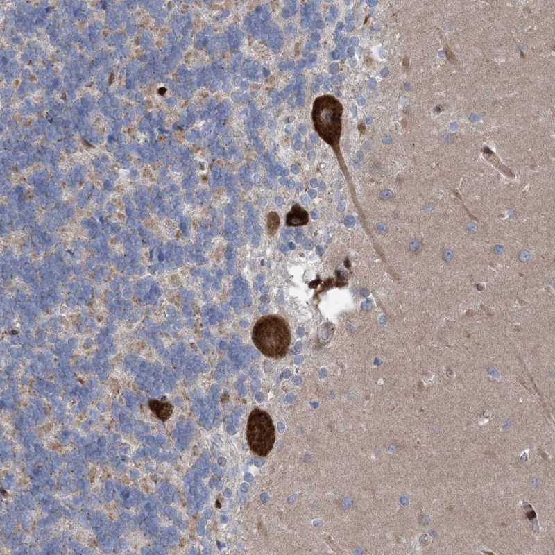 RBMS3 Antibody - BSA Free Immunohistochemistry-Paraffin: RBMS3 Antibody [NBP1-89497]
