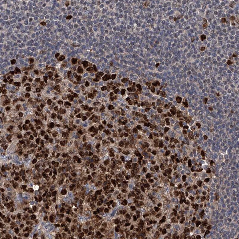 PCNA Antibody - BSA Free Immunohistochemistry-Paraffin: PCNA Antibody - BSA Free [NBP1-89503]