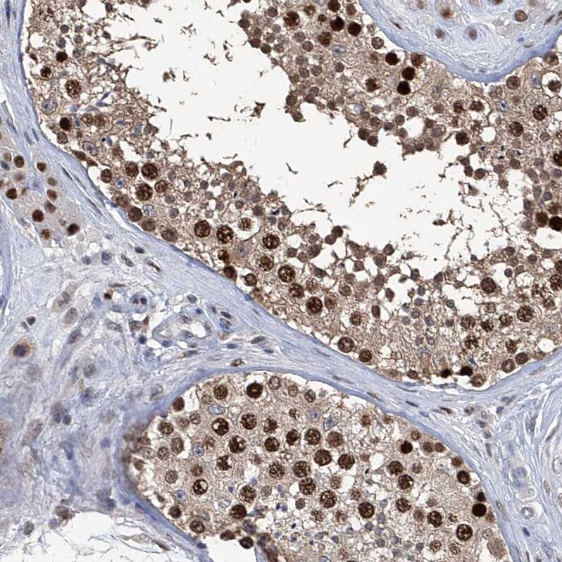 PCNA Antibody - BSA Free Immunohistochemistry-Paraffin: PCNA Antibody - BSA Free [NBP1-89503]