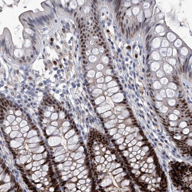 PCNA Antibody - BSA Free Immunohistochemistry-Paraffin: PCNA Antibody - BSA Free [NBP1-89503]