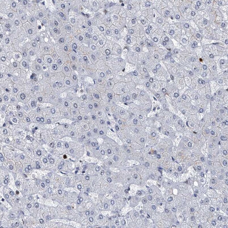 PCNA Antibody - BSA Free Immunohistochemistry-Paraffin: PCNA Antibody - BSA Free [NBP1-89503]