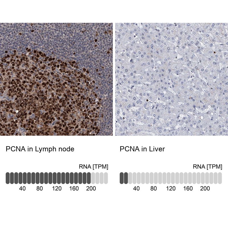 PCNA Antibody - BSA Free Immunohistochemistry-Paraffin: PCNA Antibody - BSA Free [NBP1-89503]