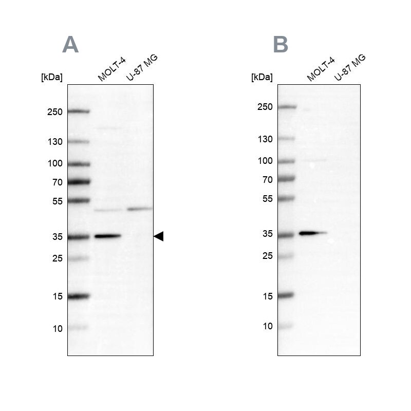 PCNA Antibody - BSA Free Western Blot: PCNA Antibody - BSA Free [NBP1-89504]
