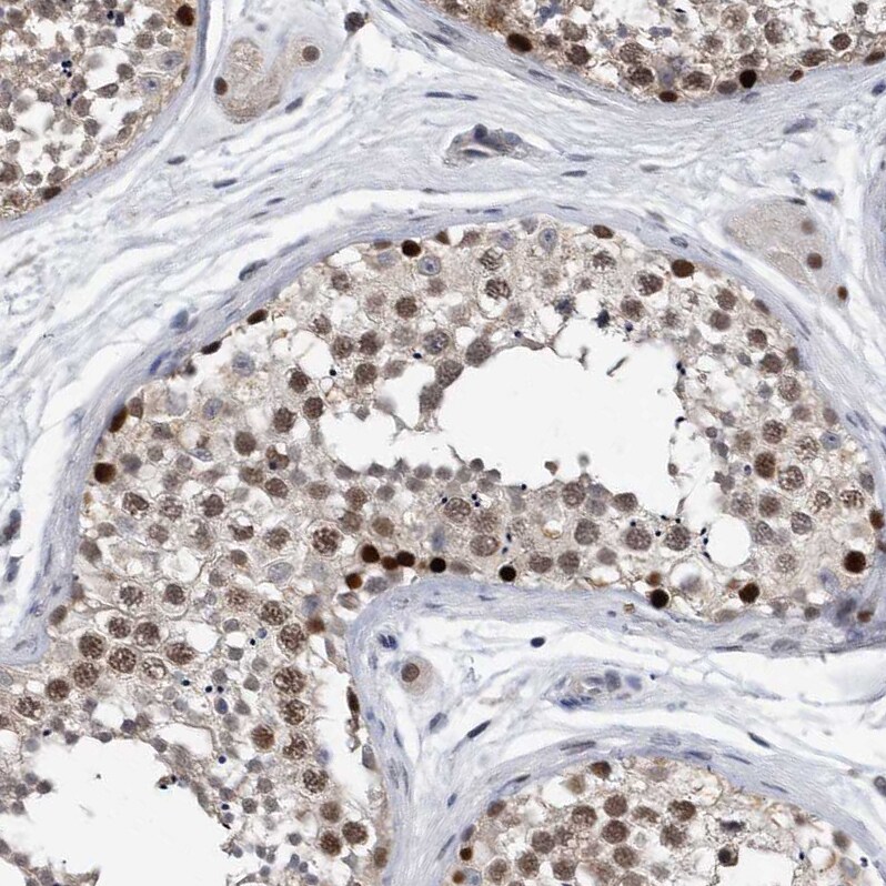 PCNA Antibody - BSA Free Immunohistochemistry-Paraffin: PCNA Antibody - BSA Free [NBP1-89504]