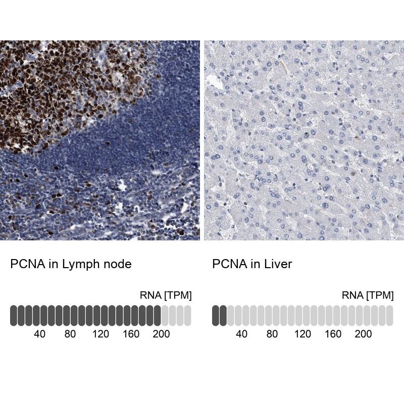 PCNA Antibody - BSA Free Immunohistochemistry-Paraffin: PCNA Antibody - BSA Free [NBP1-89504]