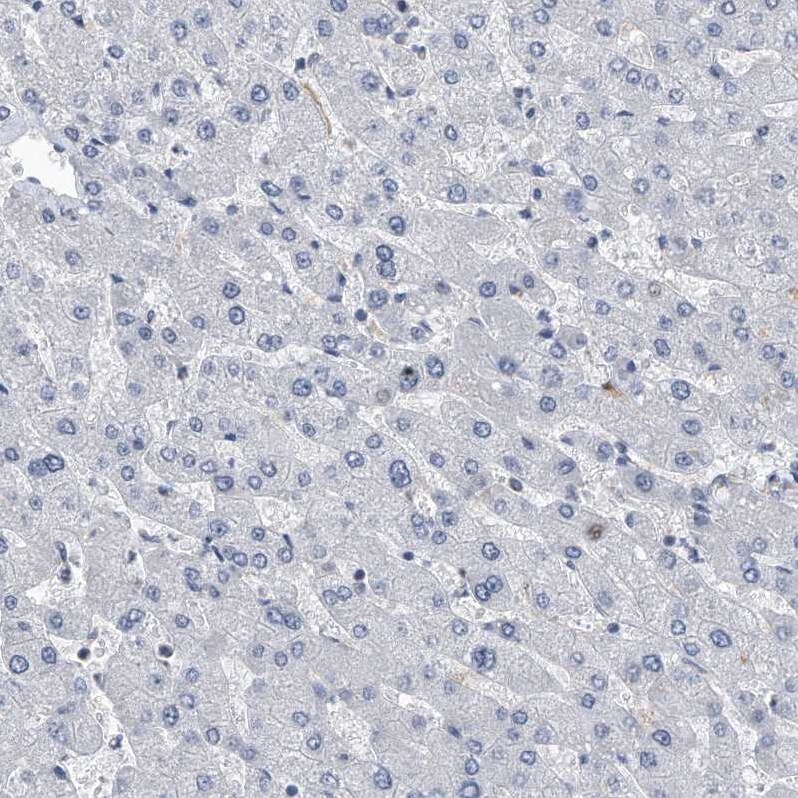 PCNA Antibody - BSA Free Immunohistochemistry-Paraffin: PCNA Antibody - BSA Free [NBP1-89504]