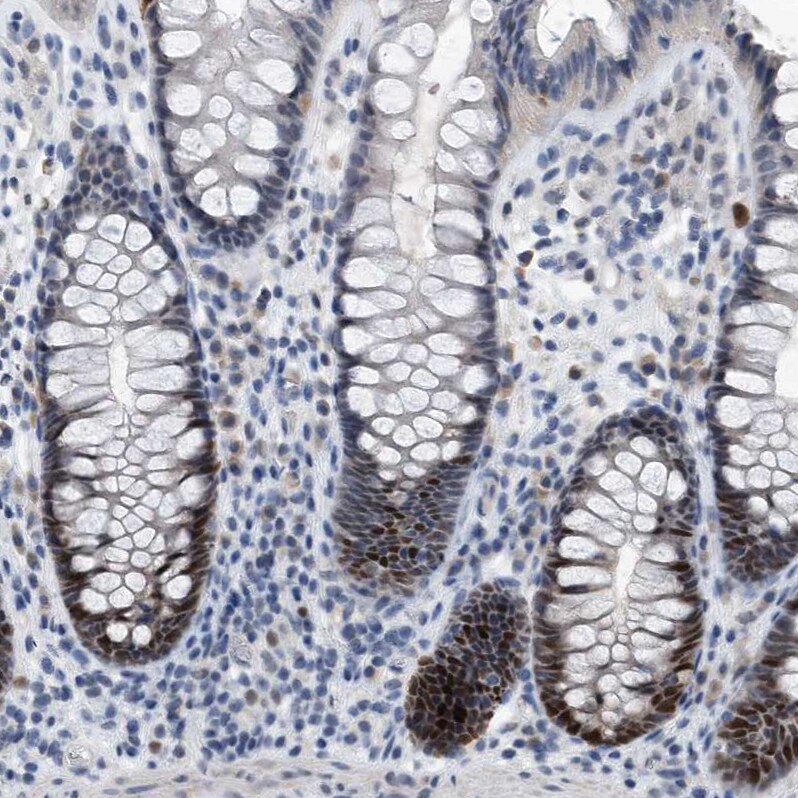PCNA Antibody - BSA Free Immunohistochemistry-Paraffin: PCNA Antibody - BSA Free [NBP1-89504]