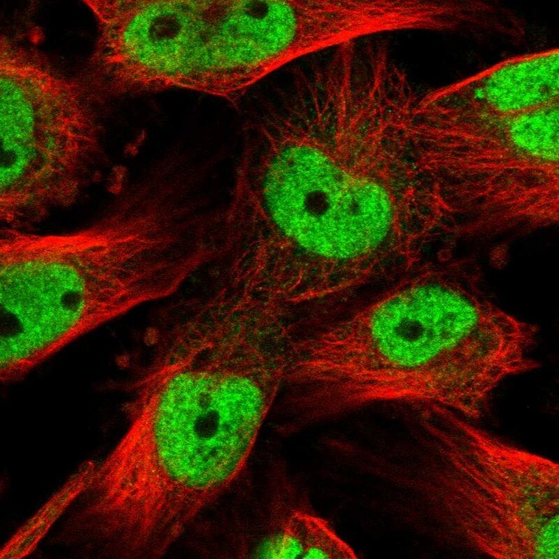 SOX4 Antibody - BSA Free Immunocytochemistry/ Immunofluorescence: SOX4 Antibody [NBP1-89506]