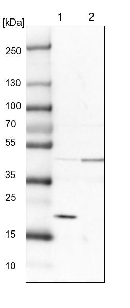 SRP19 Antibody - BSA Free Western Blot: SRP19 Antibody - BSA Free [NBP1-89507]